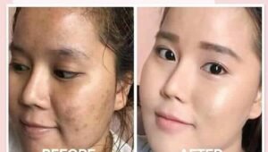 Merawat Kulit Wajah Lebih Sehat dan Cerah Merona Bersama MS Glow