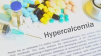 Berbahaya! Terlalu Banyak Kalsium Bisa Menyebabkan Hiperkalsemia